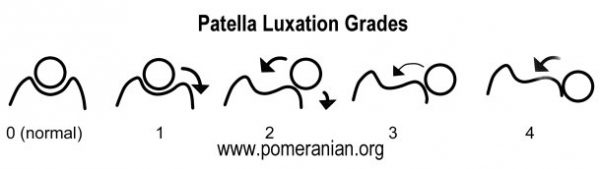 Patella luxation – Grades Of Severity