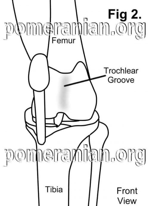 severe patella luxation